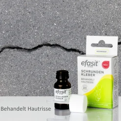 Flüssigpflaster Schrunden Kleber, 7 ml